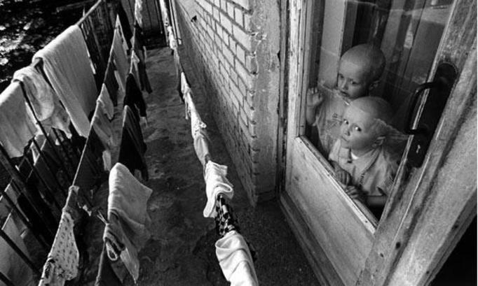 Дети мутанты Чернобыля