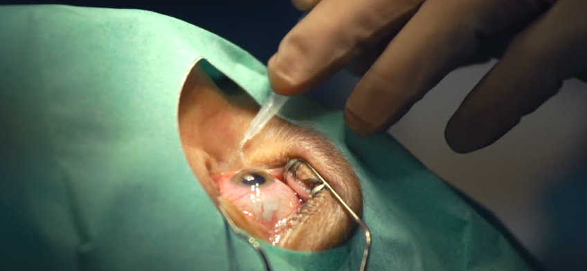 Обезболивание при операциях на глазах