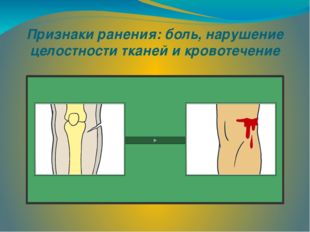 Признаки ранения: боль, нарушение целостности тканей и кровотечение 