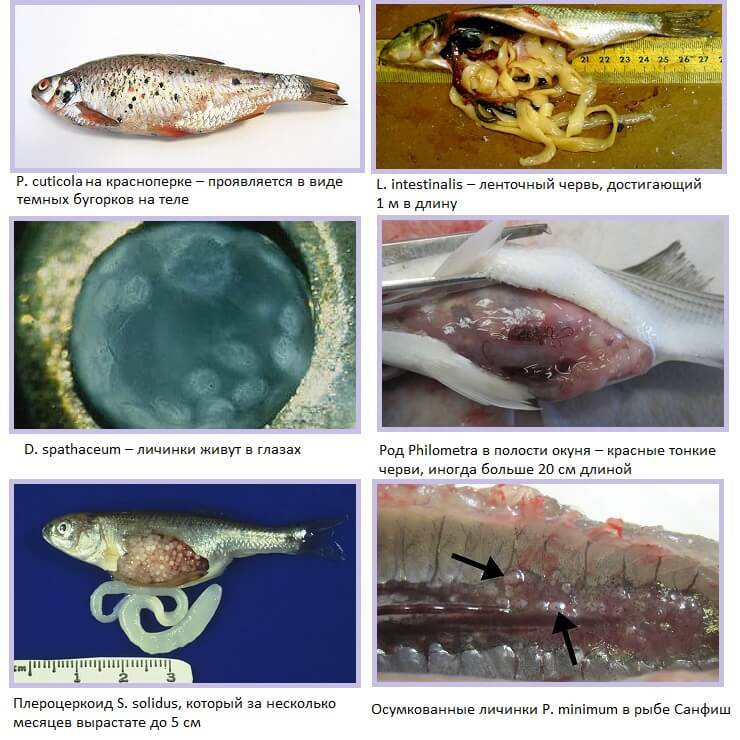 Гельминты в рыбе: опасные и безопасные для человека