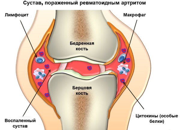 Кора ивы. Лечебные свойства, состав, применение в народной медицине и косметологии. Заготовка и хранение