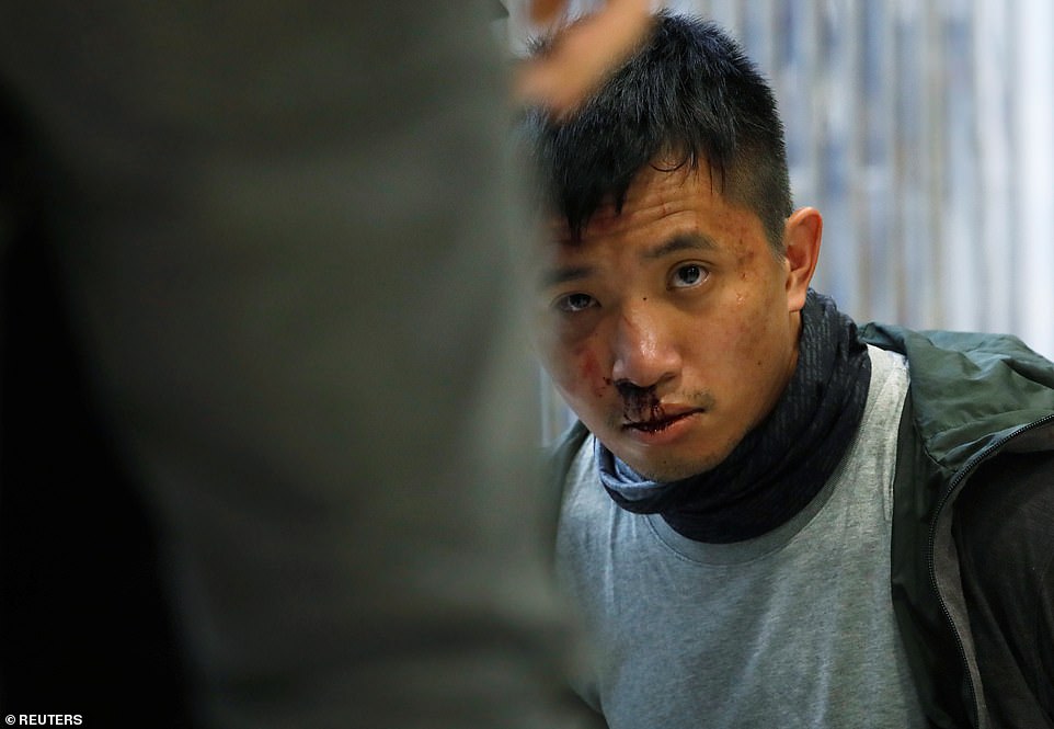 A protester with a bloodied nose and mouth is seen after being apprehended by riot police at the Sheung Shui mall in Hong Kong