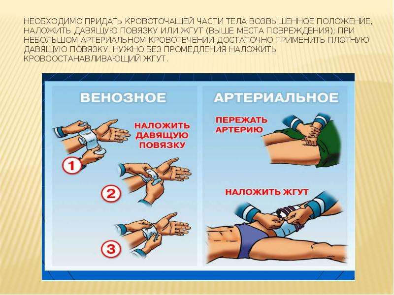 Черный стул при кровотечении