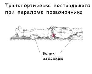 Вакуумный матрас для транспортировки пострадавших инструкция